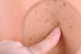 Poradnia dermatologiczna w Chrzanowie