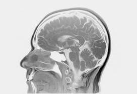 Poradnia neurologiczna w Chrzanowie